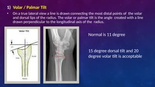 distal end radius fracture and its management | PPTX
