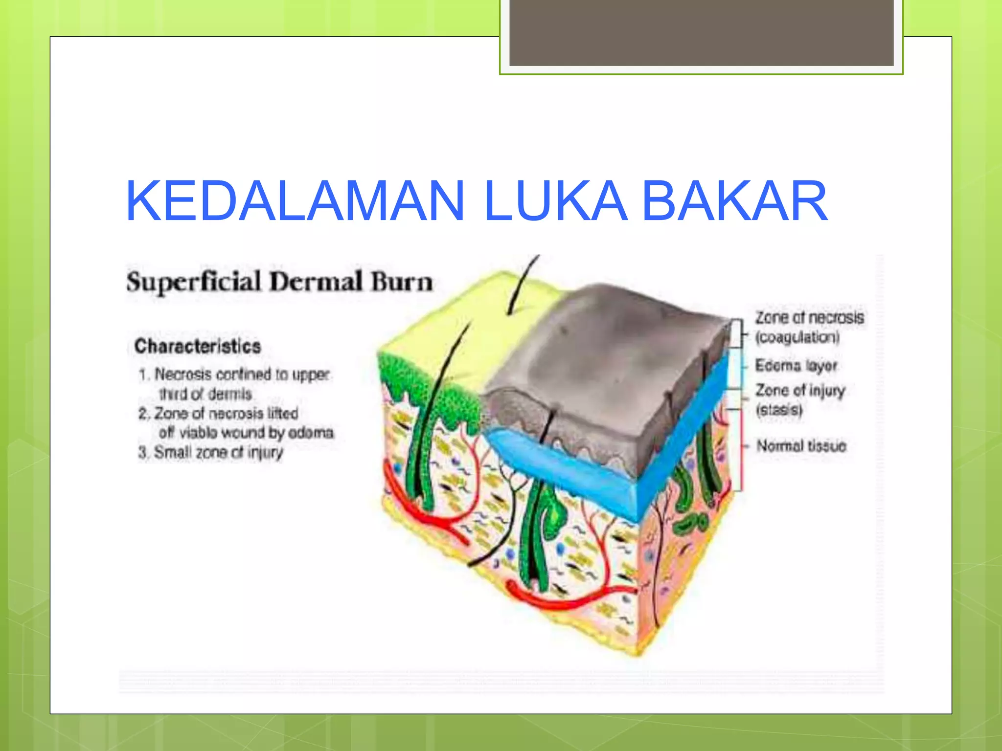 Derajat luka bakar | PPTX