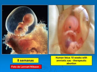 Human fetus 10 weeks with
     8 semanas            amniotic sac - therapeutic
                                  abortion
Foto de Lennart Nilsson
 