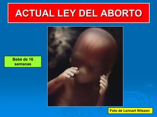 ACTUAL LEY DEL ABORTO



Bebé de 16
 semanas




                Foto de Lennart Nilsson
 