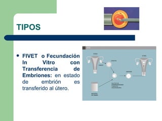 TIPOS


   FIVET o Fecundación
    In       Vitro        con
    Transferencia          de
    Embriones: en estado
    de       embrión       es
    transferido al útero.
 
