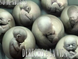 DERECHO A LA VIDA NO AL ABORTO 