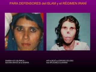 ASÍ la DEJÓ su ESPOSO CELOSO  tras APLICARLE la SHARIA SHARIA=LEY ISLÁMICA –  ASÍ ERA ANTES de la SHARIA  