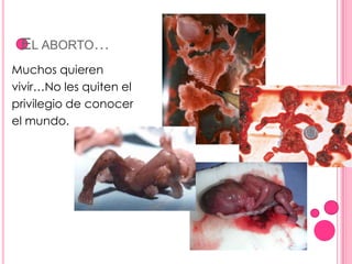 El aborto…<br />Muchos quieren<br />vivir…No les quiten el<br />privilegio de conocer<br />el mundo.<br />