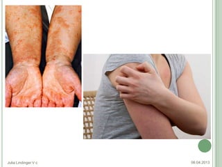 Julia Lindinger V c   06.04.2013
 