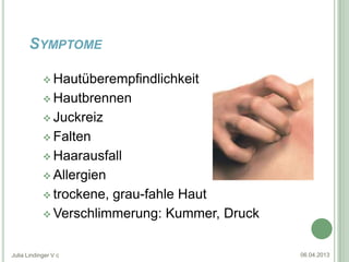 SYMPTOME

             Hautüberempfindlichkeit

             Hautbrennen

             Juckreiz

             Falten

             Haarausfall

             Allergien

             trockene,grau-fahle Haut
             Verschlimmerung: Kummer, Druck



Julia Lindinger V c                            06.04.2013
 