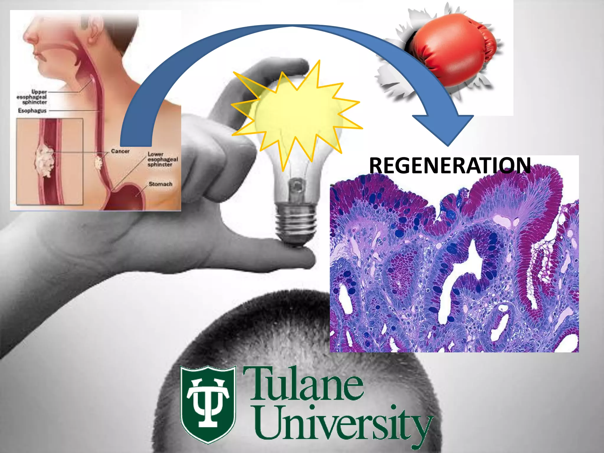 REGENERATION
 