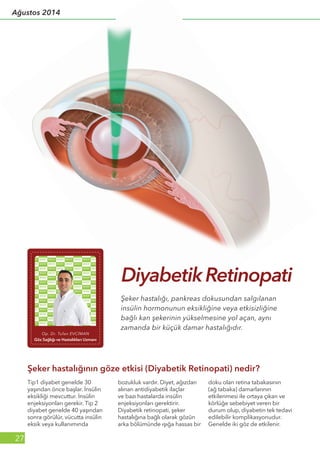 27
Ağustos 2014
Şeker hastalığının göze etkisi (Diyabetik Retinopati) nedir?
Tip1 diyabet genelde 30
yaşından önce başlar. İnsülin
eksikliği mevcuttur. İnsülin
enjeksiyonları gerekir. Tip 2
diyabet genelde 40 yaşından
sonra görülür, vücutta insülin
eksik veya kullanımında
bozukluk vardır. Diyet, ağızdan
alınan antidiyabetik ilaçlar
ve bazı hastalarda insülin
enjeksiyonları gerektirir.
Diyabetik retinopati, şeker
hastalığına bağlı olarak gözün
arka bölümünde ışığa hassas bir
doku olan retina tabakasının
(ağ tabaka) damarlarının
etkilenmesi ile ortaya çıkan ve
körlüğe sebebiyet veren bir
durum olup, diyabetin tek tedavi
edilebilir komplikasyonudur.
Genelde iki göz de etkilenir.
Şeker hastalığı, pankreas dokusundan salgılanan
insülin hormonunun eksikliğine veya etkisizliğine
bağlı kan şekerinin yükselmesine yol açan, aynı
zamanda bir küçük damar hastalığıdır.
Diyabetik Retinopati
Op. Dr. Tufan EVCİMAN
Göz Sağlığı ve Hastalıkları Uzmanı
 