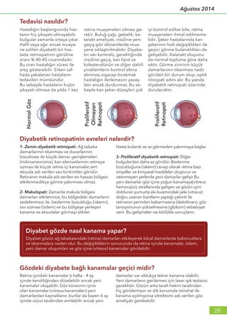 28
Ağustos 2014
Hastalığın başlangıcında has-
tanın hiç şikayeti olmayabilir
bulgular zamanla ortaya çıkar.
Hafif veya ağır ancak muaye-
ne edilen diyabetli bir has-
tada retinopatinin görülme
oranı % 40-45 civarındadır.
Bu oran hastalığın süresi ile
artış gösterebilir. Erken saf-
hada yakalanan hastaların
tedavileri mümkündür.
Bu sebeple hastaların hiçbir
şikayeti olmasa da yılda 1 kez
retina muayeneleri olması ge-
rekir. Buluğ çağı, gebelik, ka-
tarakt ameliyatı, insüline yeni
geçiş gibi dönemlerde mua-
yene sıklaştırılmalıdır. Diyabe-
tin sıkı kontrolü, gerektiğinde
insüline geçiş, kan lipid ve
kolesterolünün ve diğer dahili
problemlerin kontrol altına
alınması,sigarayı bırakmak
hastalığın ilerlemesini yavaş-
latır ancak durdurmaz. Bu se-
beple kan şeker düzeyleri çok
iyi kontrol edilse bile, retina
muayeneleri ihmal edilmeme-
lidir. Şeker hastalarında kan
şekerinin hızlı değişiklikleri ile
geçici görme bulanıklıkları da
gelişebilir. Katarakt oluşumu
da normal topluma göre daha
sıktır. Görme sinirinin küçük
damarlarının tıkanması nadir
görülen bir durum olup, optik
nöropati adını alır. Bu yazıda
diyabetik retinopati üzerinde
durulacaktır.
Retina içindeki kanamalar 6 hafta - 4 ay
içinde kendiliğinden düzelebilir ancak yeni
kanamalar oluşabilir. Göz küresinin içine
olan kanamalar (vitreus kanamaları) yeni
damarlardan kaynaklanır, bunlar da bazen 6 ay
içinde vücut tarafından emilebilir ancak yeni
damarlar var oldukça tekrar kanama olabilir.
Yeni damarların gerilemesi için laser ışık tedavisi
gereklidir. Gözün arka tarafı hekim tarafından
hiç görülemiyor ve dik konumda istirahat ile
kanama açılmıyorsa vitrektomi adı verilen göz
ameliyatı gerekebilir.
Gözdeki diyabete bağlı kanamalar geçici midir?
1- Zemin diyabetik retinopati: Ağ tabaka
damarlarının tıkanması ve duvarlarının
bozulması ile küçük damar genişlemeleri
(mikroanevrizma), kan elemanlarının retinaya
sızması ile küçük retina içi kanamalar,sert
eksuda adı verilen sarı birikintiler görülür.
Retinanın makula adı verilen en hassas bölgesi
etkilenmedikçe görme yakınması olmaz.
2- Makulopati: Zamanla makula bölgesi
damarları etkilenince, bu bölgedeki damarların
zedelenmesi ile, beslenme bozukluğu (iskemi),
sıvı sızması (ödem) ve bu bölgeye yerleşen
kanama ve eksudalar görmeyi etkiler.
Hasta bulanık ve az görmeden yakınmaya başlar.
3- Proliferatif diyabetik retinopati: Diğer
bulgulardan daha az görülür. Beslenme
bozukluğuna (iskemi) cevap olarak retina bazı
sinyaller ve kimyasal maddeler oluşturur ve
istenmeyen yerlerde yeni damarlar gelişir.Bu
yeni damarlar göz içine yoğun kanamaya(vitreus
hemorajisi), etraflarında gelişen ve gözün içini
dolduran yumurta akı kıvamındaki jele (vitreus)
doğru uzanan bantların yaptığı çekinti ile
retinanın yerinden kabarmasına (dekolman), göz
tansiyonunun yükselmesine (glokom) sebebiyet
verir. Bu gelişmeler ise körlükle sonuçlanır.
Diyabetik retinopatinin evreleri nelerdir?
Diyabet gözde nasıl kanama yapar?
Diyabet gözün ağ tabakasındaki (retina) damarları etkileyerek kılcal damarlarda baloncuklara
ve tıkanmalara neden olur. Bu değişikliklerin sonucunda da retina içinde kanamalar, ödem,
yeni damar oluşumları ve göz içine (vitreus) kanamalar görülebilir.
Tedavisi nasıldır?
NormalGöz
Proliferatif
Olmayan
Retinopati
Proliferatif
Retinopati
 