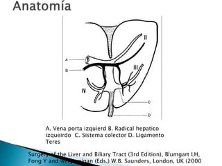 Surgery of the Liver and Biliary Tract (3rd Edition), Blumgart LH,
Fong Y and WH Jarnigan (Eds.) W.B. Saunders, London, UK (2000
A. Vena porta izquierd B. Radical hepatico
izqueirdo C. Sistema colector D. Ligamento
Teres
 