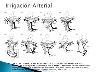  THE BLOOD SUPPLY OF THE BILIARY DUCTAL SYSTEM AND ITS RELEVANCE TO
VASCULOBILIARY INJURIES FOLLOWINGCHOLECYSTECTOMY IVO D. VELLAR Department
of Surgery, University of Melbourne, St Vincent’s Hospital, Fitzroy, Victoria, Australia.
Australia New Zealan Journal of Surgery 2000 69 , 816-820
 