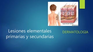 Lesiones elementales
primarias y secundarias
DERMATOLOGIA
 