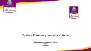 Hugo Alberto Cervantes Flores
259803
Grupo 9-10
Quistes, fibromas y queratoacantoma
 