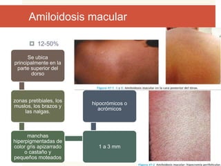 Enfermedades Del Metabolismo Y Por Dep sito PPTX