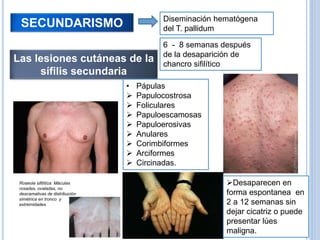 SECUNDARISMO Diseminación hematógena
del T. pallidum
Las lesiones cutáneas de la
sífilis secundaria
6 - 8 semanas después
de la desaparición de
chancro sifilítico
• Pápulas
 Papulocostrosa
 Foliculares
 Papuloescamosas
 Papuloerosivas
 Anulares
 Corimbiformes
 Arciformes
 Circinadas.
Desaparecen en
forma espontanea en
2 a 12 semanas sin
dejar cicatriz o puede
presentar lúes
maligna.
Roseola sifilítica: Máculas
rosadas, ovaladas, no
descamativas de distribución
simétrica en tronco y
extremidades.
 