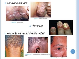  condylomata lata
 Perionixis
 Alopecia en “mordidas de ratón”
 