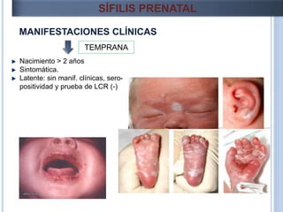 MANIFESTACIONES CLÍNICAS
SÍFILIS PRENATAL
TEMPRANA
Nacimiento > 2 años
Sintomática.
Latente: sin manif. clínicas, sero-
positividad y prueba de LCR (-)
 