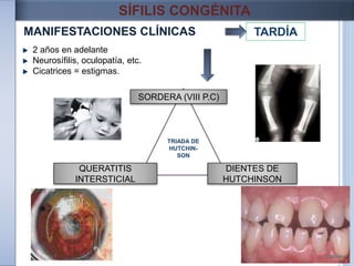 MANIFESTACIONES CLÍNICAS
SÍFILIS CONGÉNITA
TARDÍA
TRIADA DE
HUTCHIN-
SON
SORDERA (VIII P.C)
QUERATITIS
INTERSTICIAL
DIENTES DE
HUTCHINSON
2 años en adelante
Neurosífilis, oculopatía, etc.
Cicatrices = estigmas.
 