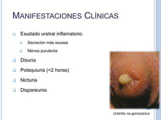  Exudado uretral inflamatorio
 Secreción más escasa
 Menos purulenta
 Disuria
 Polaquiuria (<2 horas)
 Nicturia
 Dispareunia
MANIFESTACIONES CLÍNICAS
Uretritis no gonocócica
 