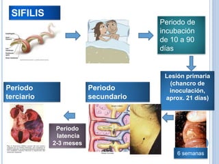 SIFILIS
Periodo de
incubación
de 10 a 90
días
Lesión primaria
(chancro de
inoculación,
aprox. 21 días)
Periodo
secundario
Periodo
latencia
2-3 meses
Periodo
terciario
6 semanas
 