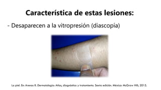 dermatologia exploracion de la piel y lesiones elementales | PPTX