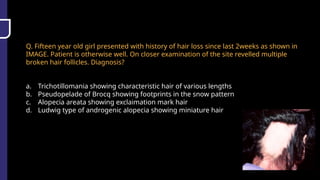 Q. Fifteen year old girl presented with history of hair loss since last 2weeks as shown in
IMAGE. Patient is otherwise well. On closer examination of the site revelled multiple
broken hair follicles. Diagnosis?
a. Trichotillomania showing characteristic hair of various lengths
b. Pseudopelade of Brocq showing footprints in the snow pattern
c. Alopecia areata showing exclaimation mark hair
d. Ludwig type of androgenic alopecia showing miniature hair
 