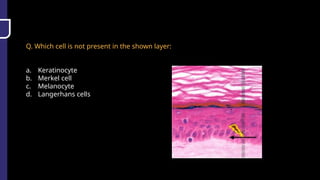 Q. Which cell is not present in the shown layer:
a. Keratinocyte
b. Merkel cell
c. Melanocyte
d. Langerhans cells
 