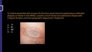 Q. Patient presented with around 10-20 b/l but asymmetrical erythematous infiltrated
plaques as shown in the IMAGE. Lessions are of varied size and bizarre shapes with
irregular borders and have geographic appearance. Diagnosis?
a. TT
b. BT
c. BB
d. LL
 