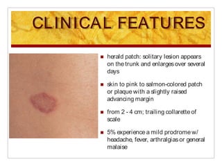 Collarette Scale Rash Derma - Papulosquamous Diseases 2021 Dr. Bunagan.pdf
