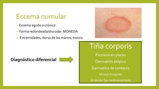 Forma Numular Sesión dermatología | PPTX
