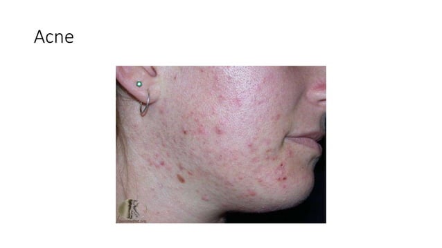 Derma by Dr danish.pptx