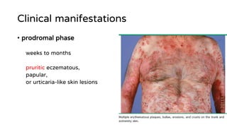 Proderma Rash Dermatology case presentation | PDF