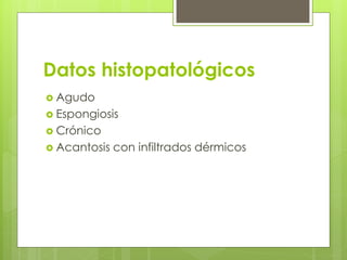 Datos histopatológicos
 Agudo
 Espongiosis
 Crónico
 Acantosis con infiltrados dérmicos
 