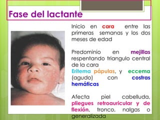 Fase del lactante
Inicio en cara entre las
primeras semanas y los dos
meses de edad
Predominio en mejillas
respentando triangulo central
de la cara
Eritema pápulas, y eccema
(agudo) con costras
hemáticas
Afecta piel cabelluda,
pliegues retroauricular y de
flexión, tronco, nalgas o
generalizada
 