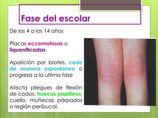 Fase del escolar
De los 4 a los 14 años
Placas eccematosas o
liquenificadas
Aparición por brotes, cede
de manera espontánea o
progresa a la ultima fase
Afecta pliegues de flexión
de codos, huecos poplíteos,
cuello, muñecas párpados
o región peribucal.
 