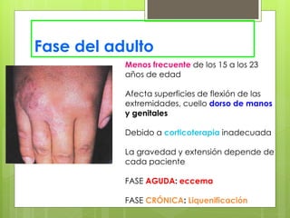 Fase del adulto
Menos frecuente de los 15 a los 23
años de edad
Afecta superficies de flexión de las
extremidades, cuello dorso de manos
y genitales
Debido a corticoterapia inadecuada
La gravedad y extensión depende de
cada paciente
FASE AGUDA: eccema
FASE CRÓNICA: Liquenificación
 