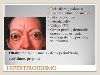    Piel caliente, sudorosa
                           Epidermis fina, no atrófica
                           Pelo: fino, caída
                           Pérdida vello
                           Vitíligo (7%)
                           Otros: prurito, dermatitis
                            eczematosa, urticaria,
                            dermografismo, púrpura,
                            xantelasmas


Oftalmopatía: quemosis, edema periorbitario,
exoftalmos, proptosis

Hipertiroidismo
 