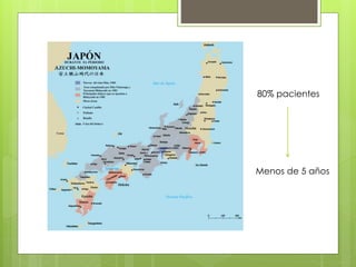 80% pacientes
Menos de 5 años
 