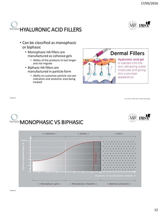 17/05/2016
12
HYALURONIC ACID FILLERS
• Can be classified as monophasic
or biphasic
• Monophasic HA fillers are
manufactured as cohesive gels
• Ability of the products to last longer
and not migrate
• Biphasic HA fillers are
manufactured in particle form
• Ability to customize particle size per
indication and anatomic area being
treated
09/04/2016
VOL. 25 NO. 4 • APRIL 2012 • CosmeticDermatology
MONOPHASIC VS BIPHASIC
09/04/2016
 