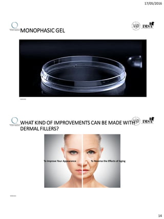 17/05/2016
14
MONOPHASIC GEL
09/04/2016
WHAT KIND OF IMPROVEMENTS CAN BE MADE WITH
DERMAL FILLERS?
09/04/2016
To Reverse the Effects of AgingTo Improve Your Appearance
 