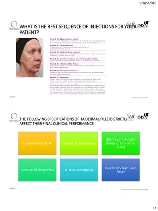 17/05/2016
32
WHAT IS THE BEST SEQUENCE OF INJECTIONS FOR YOUR
PATIENT?
09/04/2016
Image courtesy of Dr De Maio
THE FOLLOWING SPECIFICATIONS OF HA DERMAL FILLERS STRICTLY
AFFECT THEIR FINAL CLINICAL PERFORMANCE
Concentration of HA Degree of cross-linking
Quantity of HA cross-
linked vs. non-cross-
linked
Duration of filling effect G’ (elastic modulus)
Injectability (extrusion
force)
09/04/2016
Magazin für ästhetische Chirurgie 2|126. Jahrgang 2012
 