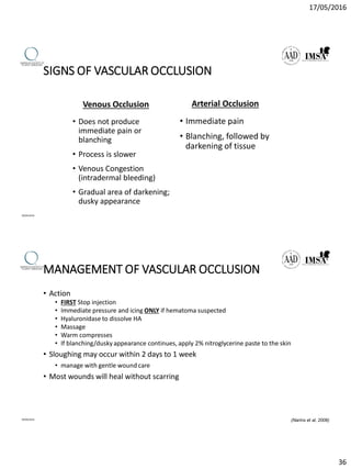 17/05/2016
36
SIGNS OF VASCULAR OCCLUSION
Venous Occlusion
• Does not produce
immediate pain or
blanching
• Process is slower
• Venous Congestion
(intradermal bleeding)
• Gradual area of darkening;
dusky appearance
Arterial Occlusion
• Immediate pain
• Blanching, followed by
darkening of tissue
09/04/2016
MANAGEMENT OF VASCULAR OCCLUSION
• Action
• FIRST Stop injection
• Immediate pressure and icing ONLY if hematoma suspected
• Hyaluronidase to dissolve HA
• Massage
• Warm compresses
• If blanching/dusky appearance continues, apply 2% nitroglycerine paste to the skin
• Sloughing may occur within 2 days to 1 week
• manage with gentle wound care
• Most wounds will heal without scarring
09/04/2016 (Narins et al, 2006)
 