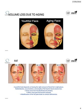 17/05/2016
4
VOLUME LOSS DUE TO AGING
09/04/2016
FAT
A youthful look depends on having the right amount of facial fat in right places.
Redistribution, accumulation, and atrophy of fat lead to facial volume loss.
• Some areas lose fat (forehead and cheeks).
• Other areas gain fat (mouth and jaw).
• Modification of the fat pads leads to contour deficiencies.
09/04/2016
 