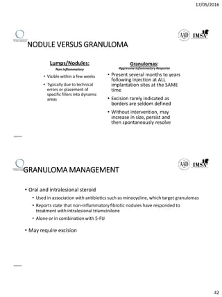 17/05/2016
42
NODULE VERSUS GRANULOMA
Lumps/Nodules:
Non Inflammatory
• Visible within a few weeks
• Typically due to technical
errors or placement of
specific fillers into dynamic
areas
Granulomas:
Aggressive Inflammatory Response
• Present several months to years
following injection at ALL
implantation sites at the SAME
time
• Excision rarely indicated as
borders are seldom defined
• Without intervention, may
increase in size, persist and
then spontaneously resolve
09/04/2016
GRANULOMA MANAGEMENT
• Oral and intralesional steroid
• Used in association with antibiotics such as minocycline, which target granulomas
• Reports state that non-inflammatory fibrotic nodules have responded to
treatment with intralesional triamcinilone
• Alone or in combination with 5-FU
• May require excision
09/04/2016
 