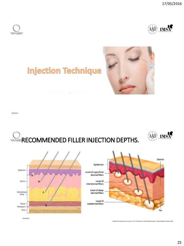 Dermal filler from basic to practice