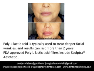 Poly-L-lactic acid is typically used to treat deeper facial
wrinkles, and results can last more than 2 years.
FDA approved Poly-L-lactic acid fillers include Sculptra®
Aesthetic.
www.facialaestheticsdelhi.com
 