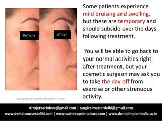 Some patients experience
mild bruising and swelling,
but these are temporary and
should subside over the days
following treatment.
You will be able to go back to
your normal activities right
after treatment, but your
cosmetic surgeon may ask you
to take the day off from
exercise or other strenuous
activity.www.facialaestheticsdelhi.com
 
