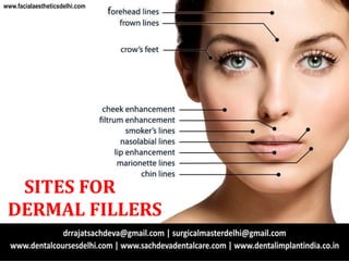 SITES FOR
DERMAL FILLERS
www.facialaestheticsdelhi.com
 