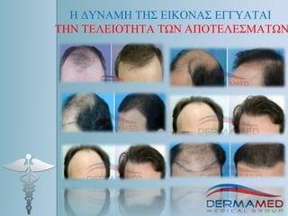 Η ΔΥΝΑΜΗ ΤΗΣ ΕΙΚΟΝΑΣ ΕΓΓΥΑΤΑΙ
ΤΗΝ ΤΕΛΕΙΟΤΗΤΑ ΤΩΝ ΑΠΟΤΕΛΕΣΜΑΤΩΝ
 