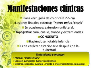 Manifestaciones clínicas
        Placa verrugosa de color café 2-5 cm.
   Lesiones lineales extensas “nevus unius lateris”
         En ocasiones: extensión unilateral.
   Topografía: cara, cuello, tronco y extremidades
                     CONGENITO
             Haciéndose notable infancia
      Es de carácter estacionario después de la
                       pubertad
                       Tratamiento y manejo:
 Motivos “COSMETICOS”
 Escisión quirúrgica: tumores pequeños
 Electrodesecación, curetaje , injerto o crioterapia: lesiones mayores
 